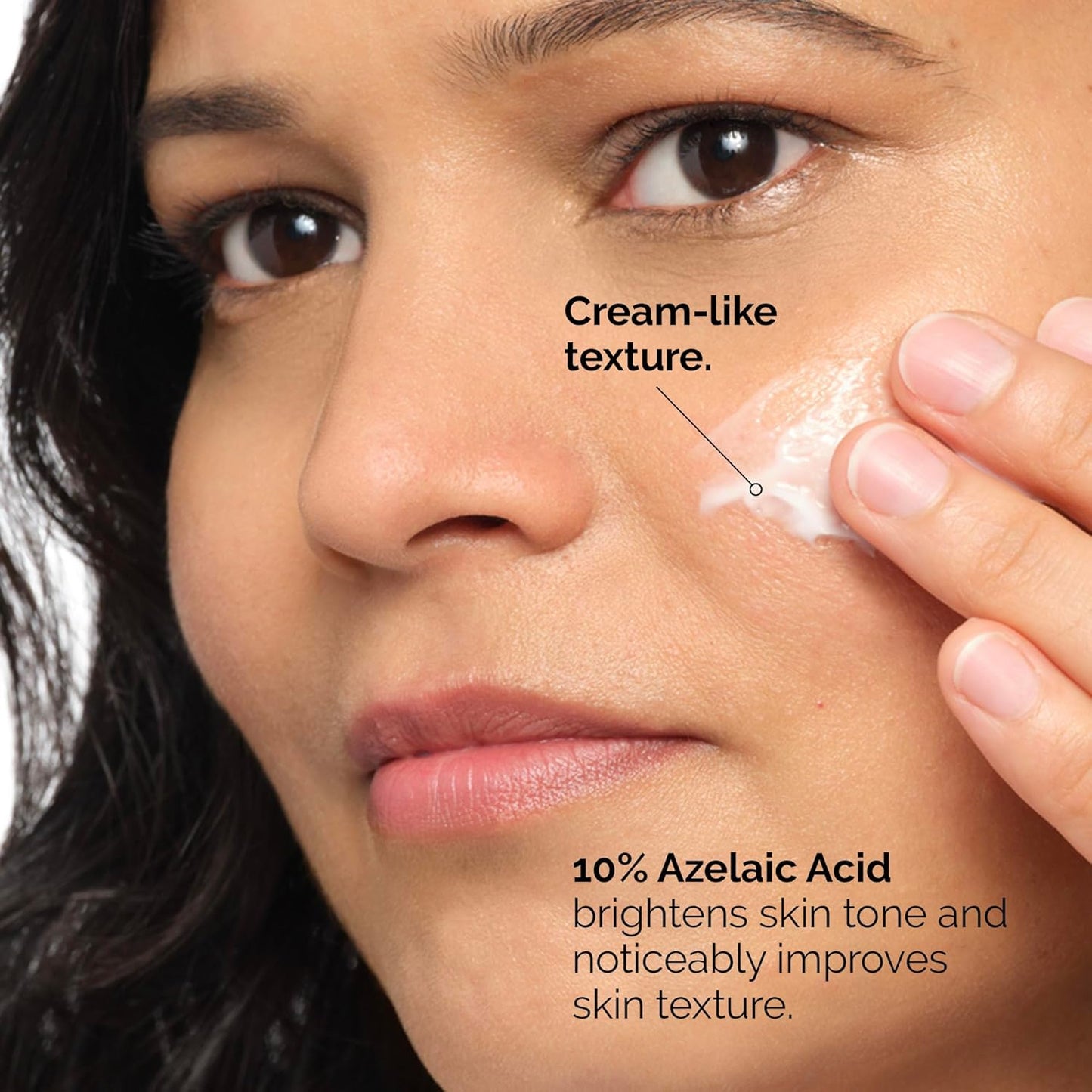 Azelaic Acid Suspension 10% 30ml/1oz